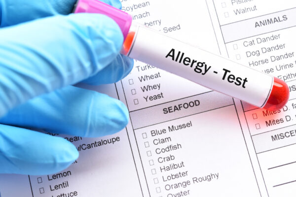 Test tube with blood sample for food allergy test